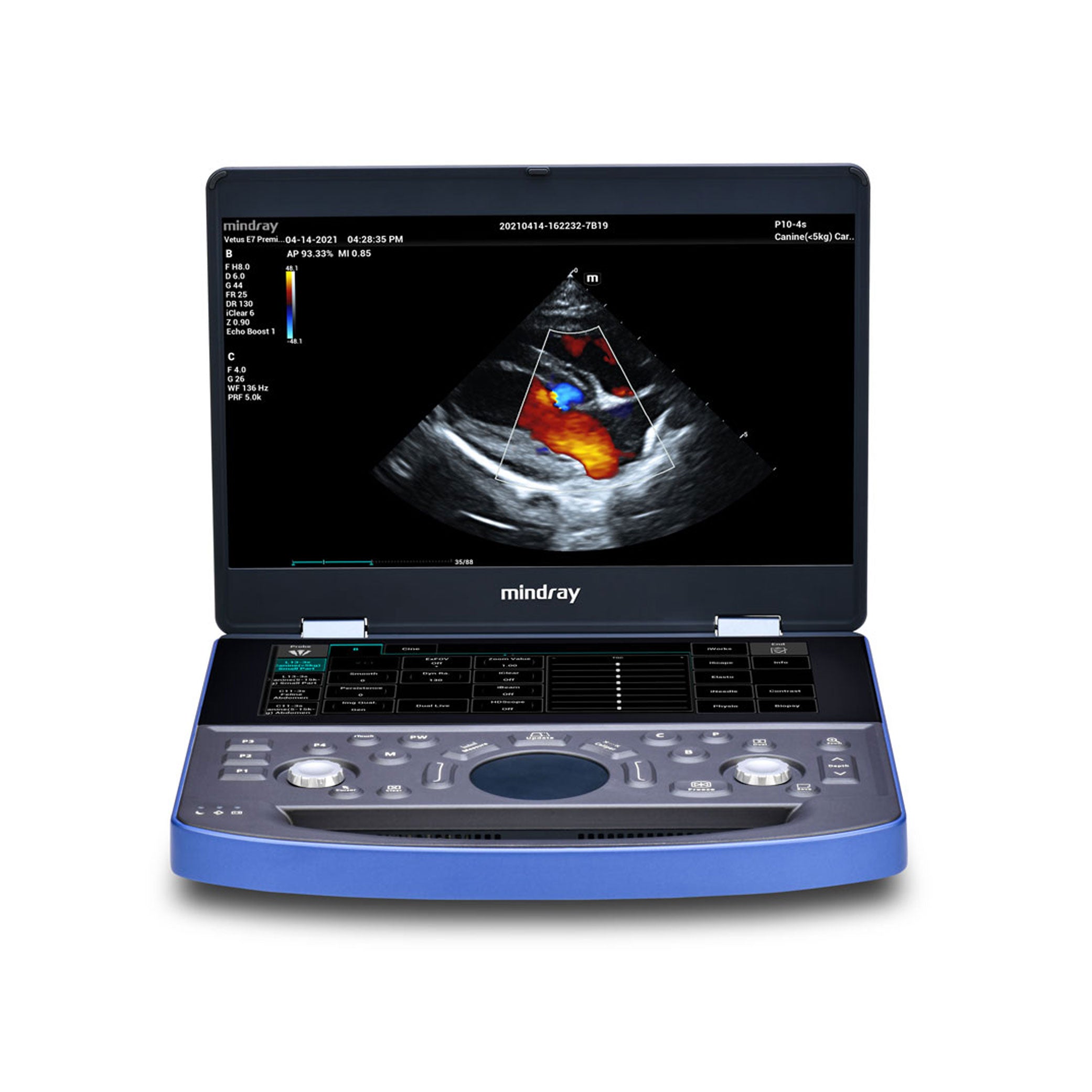 Vetus E7 Ultrasound Machine