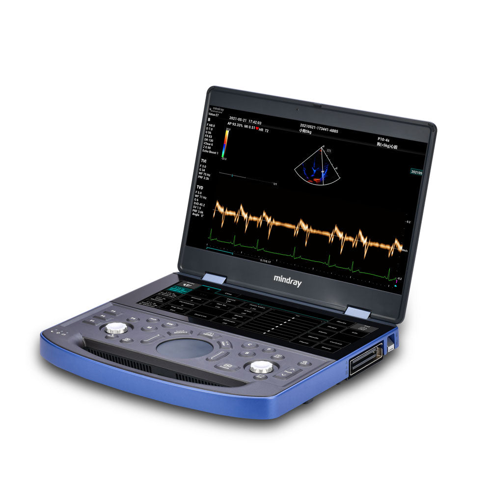 Vetus E7 Ultrasound Machine
