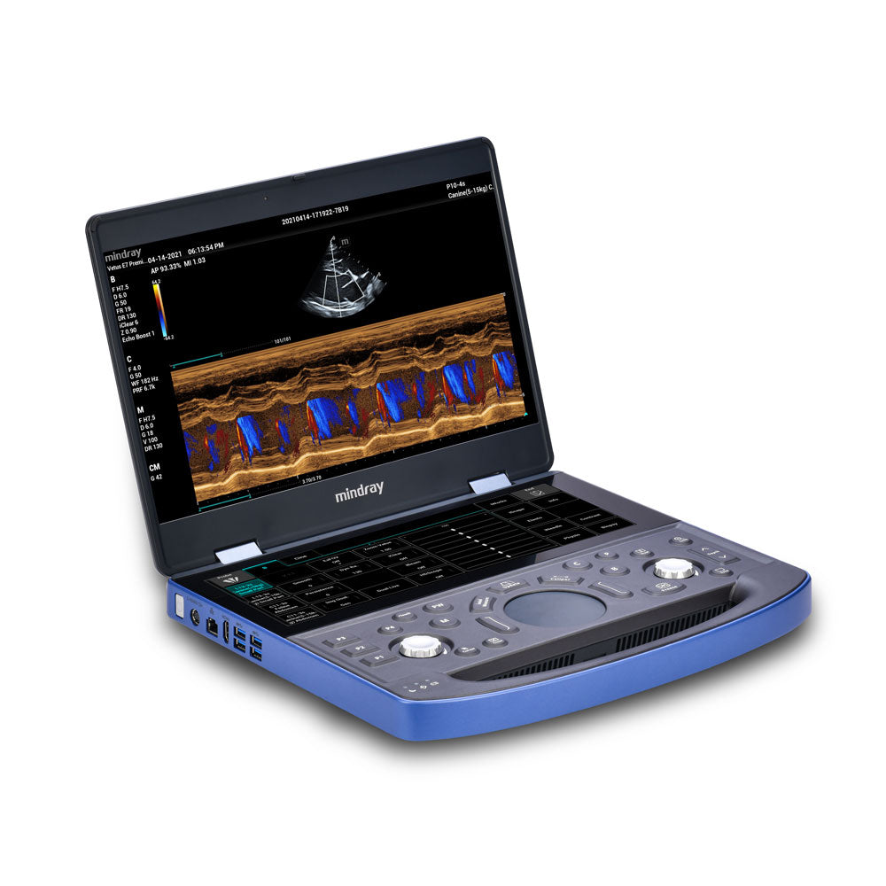 Vetus E7 Ultrasound Machine