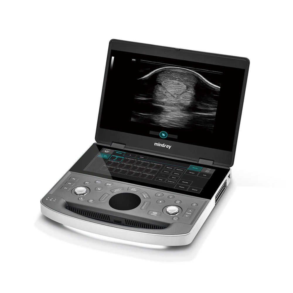 Vetus EQ Ultrasound Machine