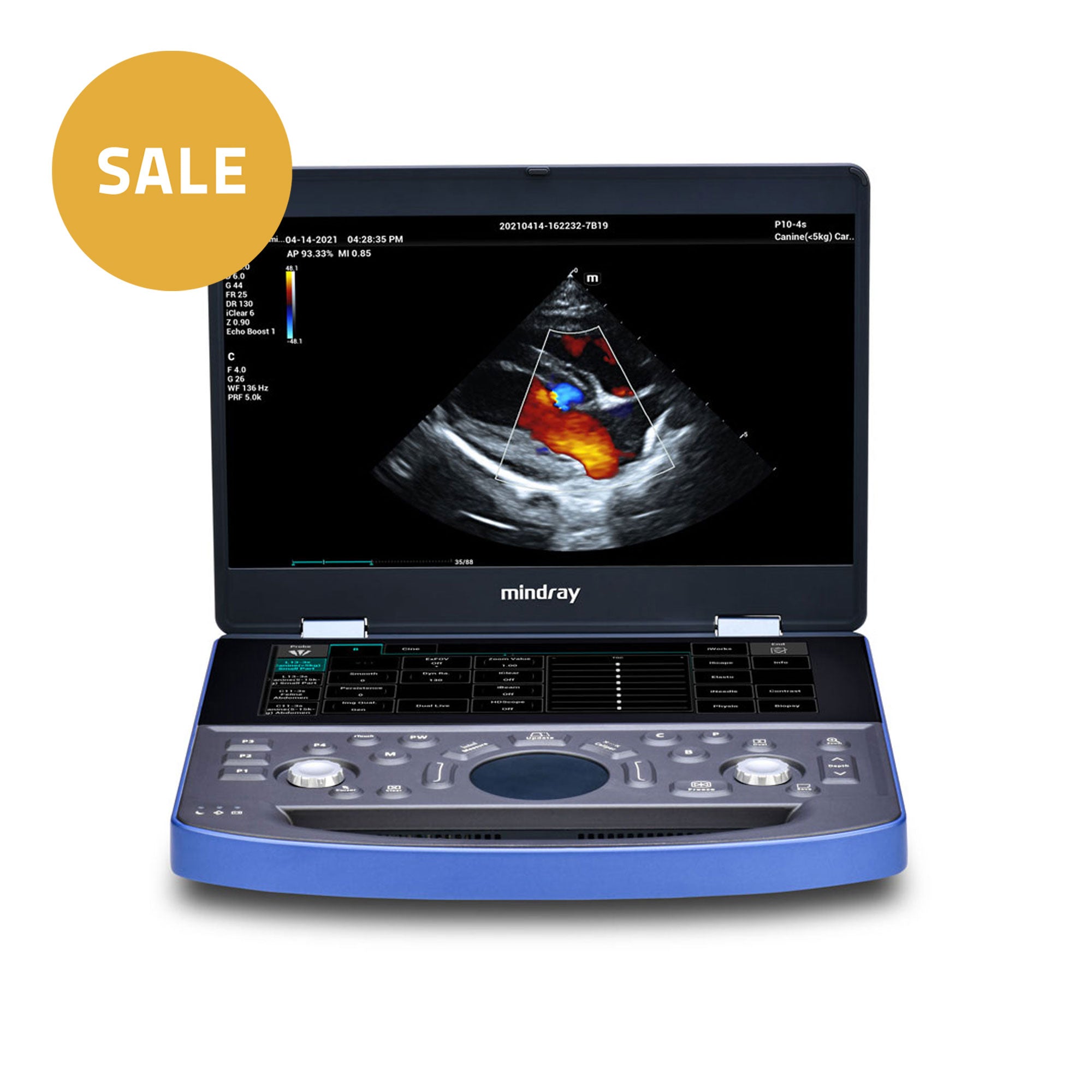 Vetus E7 Ultrasound Machine