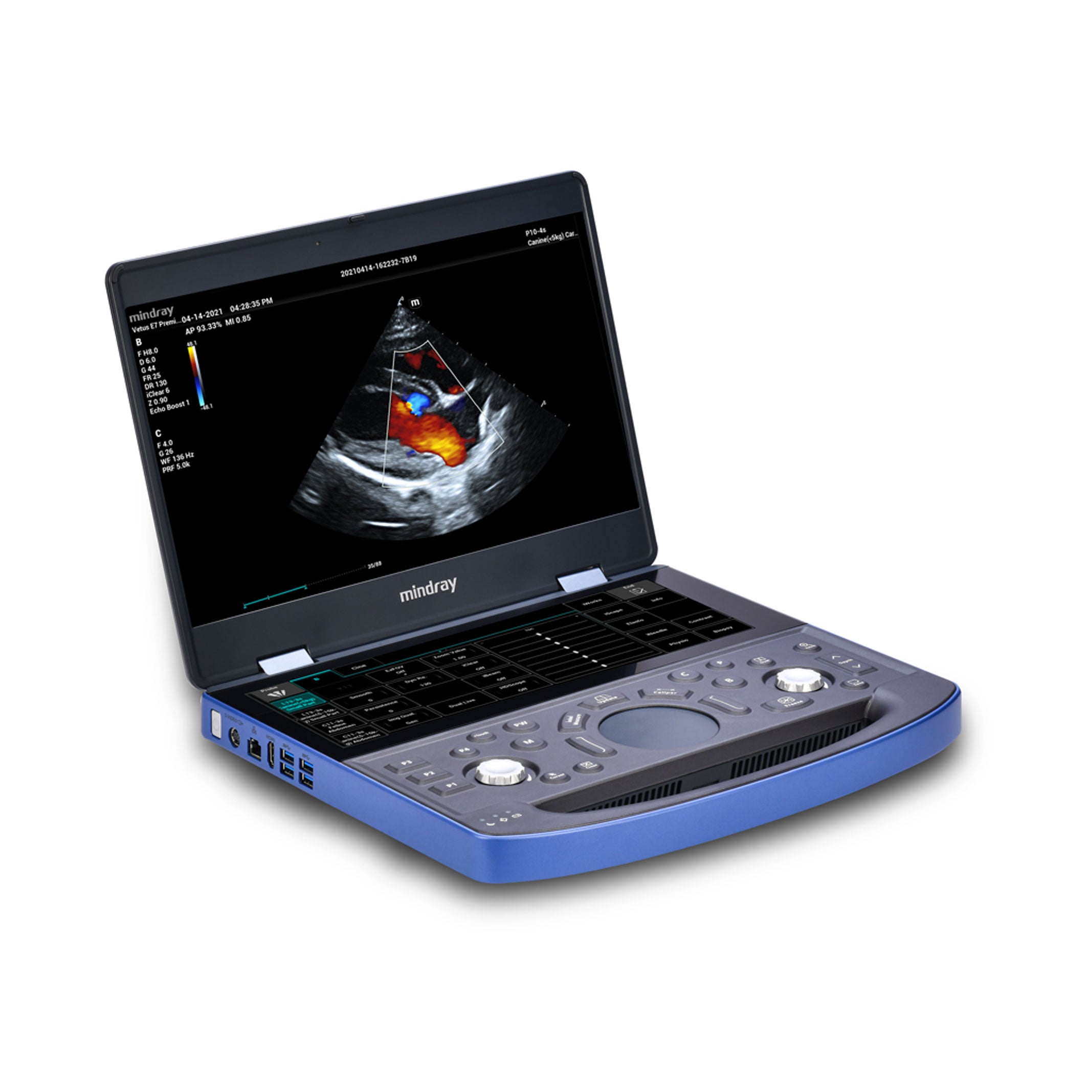 Vetus E7 Ultrasound Machine
