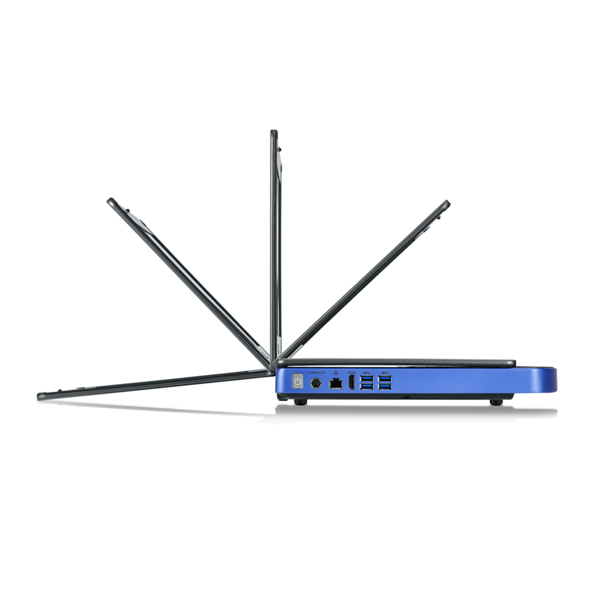 Vetus E7 Ultrasound Machine