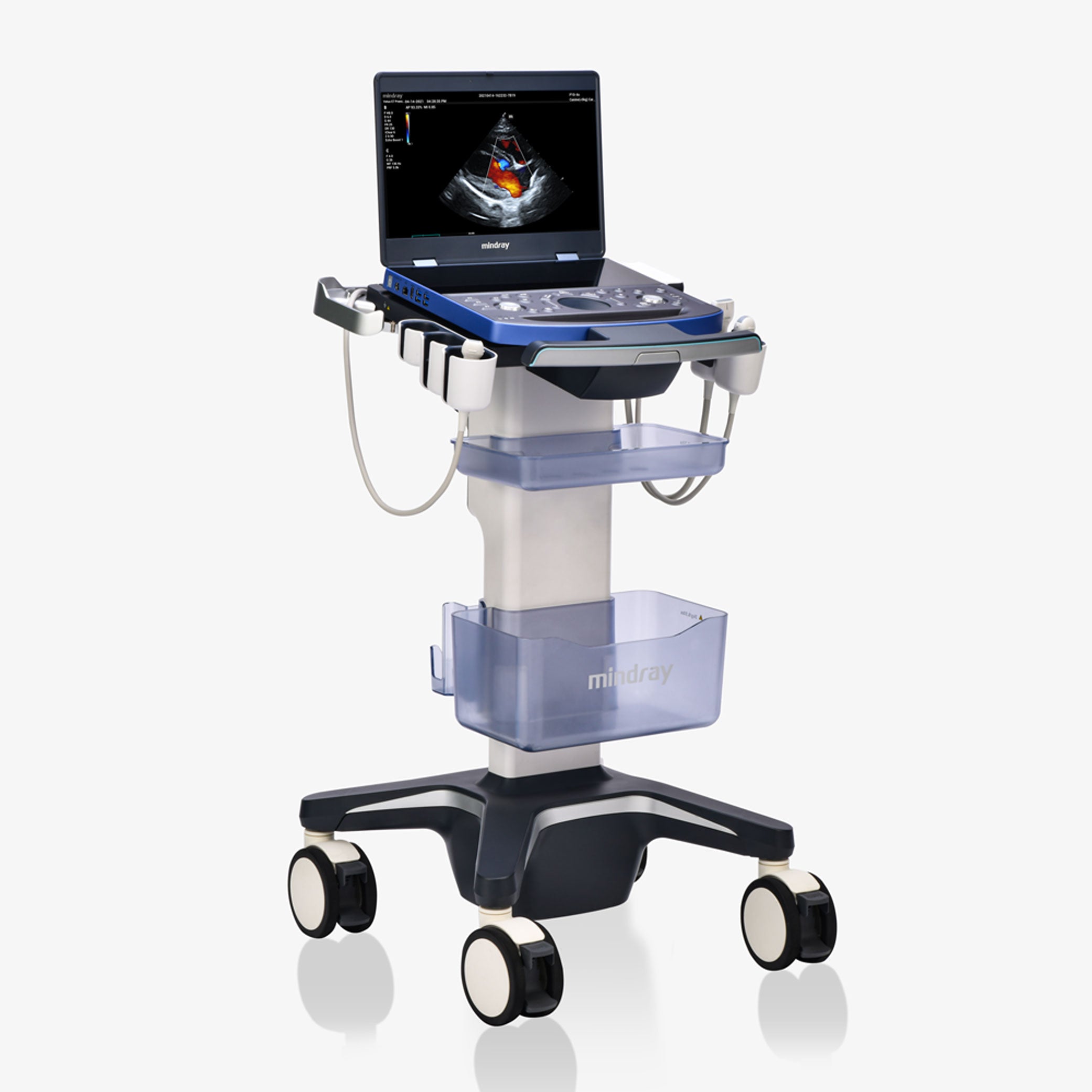 Vetus E7 Ultrasound Machine