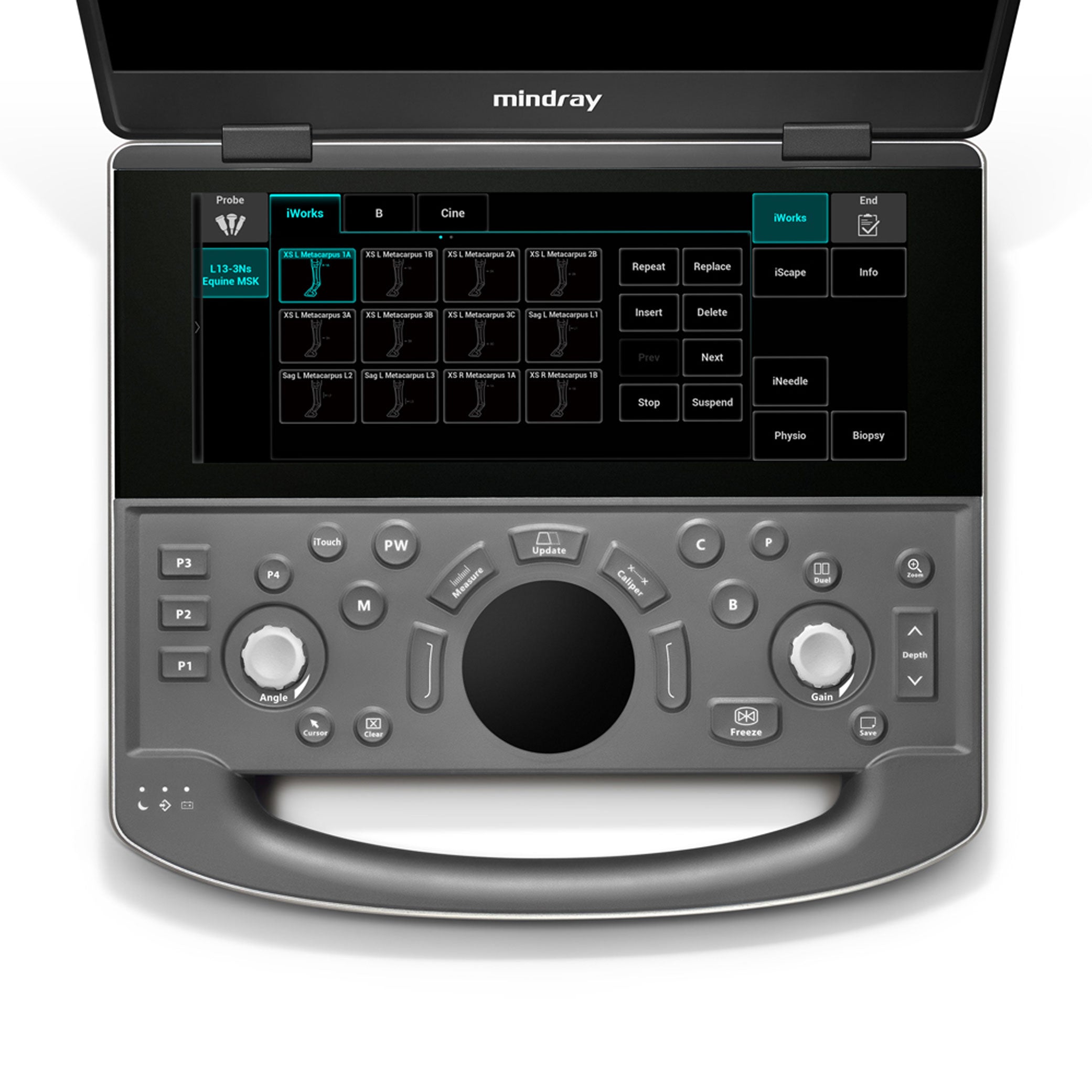 Vetus EQ Ultrasound Machine