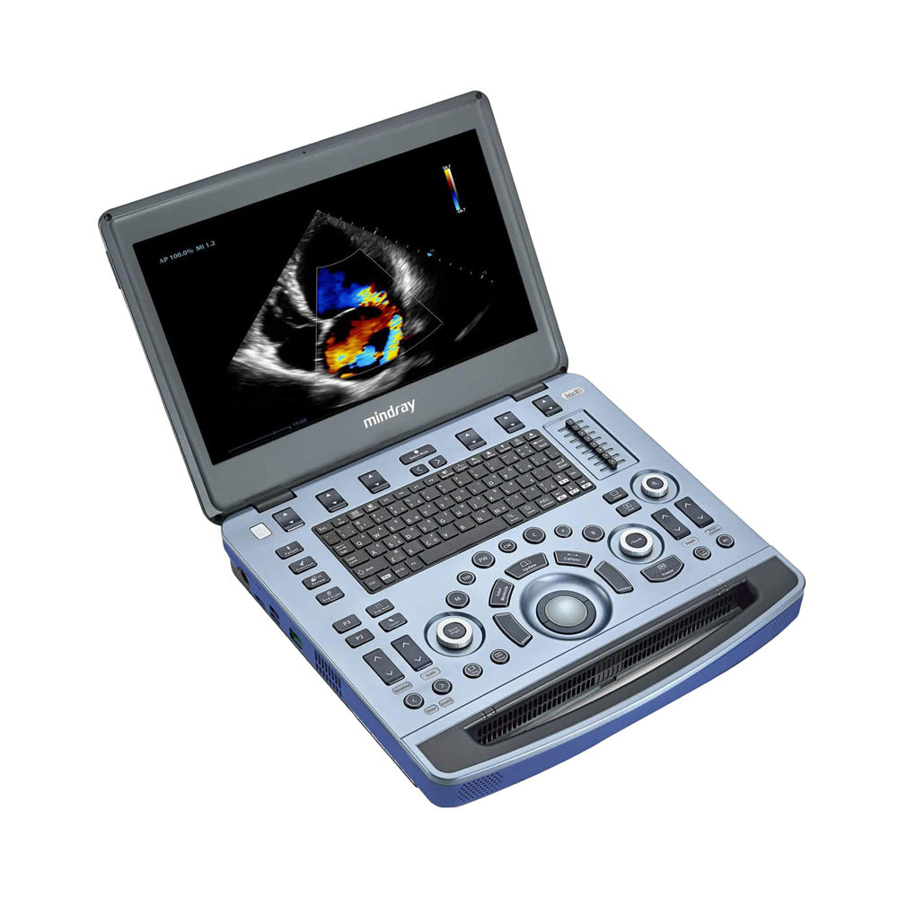 Vetus M11 Ultrasound Machine