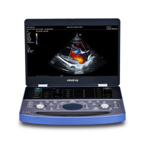 Vetus E7 Ultrasound Machine