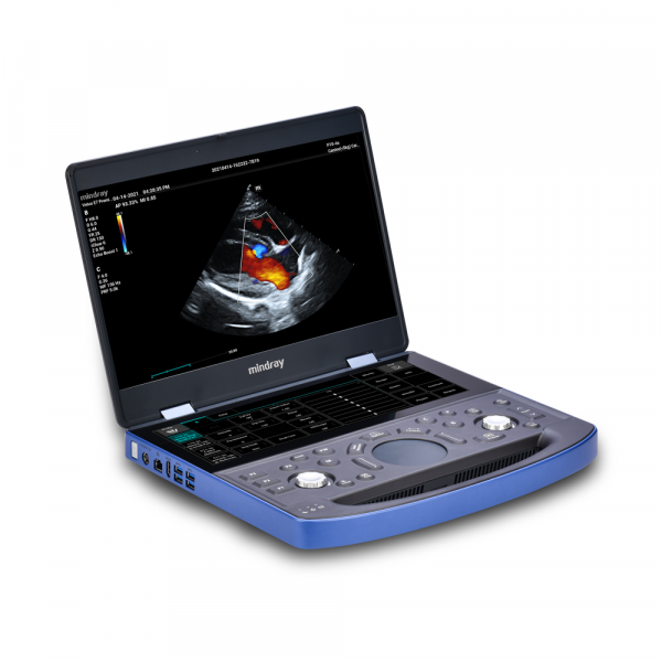 Vetus E7 Ultrasound Machine Side