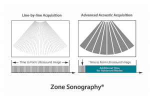 Zone Sonography