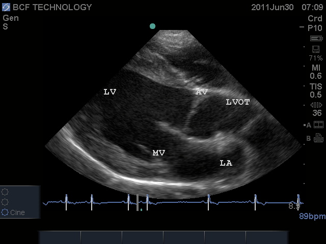 Canine RPLA LVOT Annotated C11