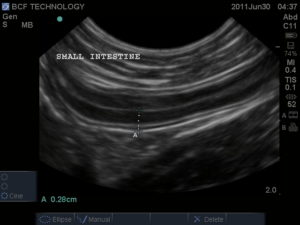 Canine Small Intestine Measured & Annotated: Sonosite M-turbo with c11x probe