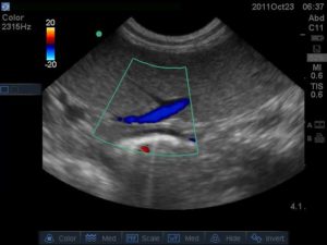 Canine Spleen with Hilar Vessels highlighted with Colour Doppler: Sonosite M-turbo with c11x probe