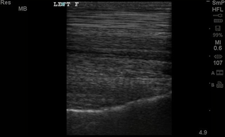 Equine Distal Limb Longitudinal HFL38