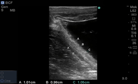 Equine Utero Placental Unit Assessment L52